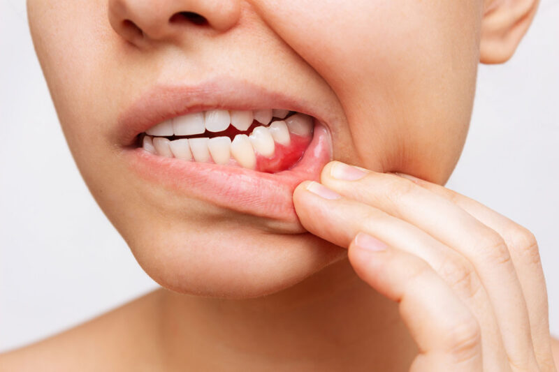 Gum Disease Treatment in Scottsdale: How Periodontal Care Helps Protect Your Smile