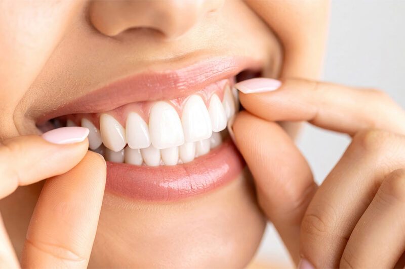Dentures in Scottsdale: Full Dentures vs. Partial Dentures and What to Expect